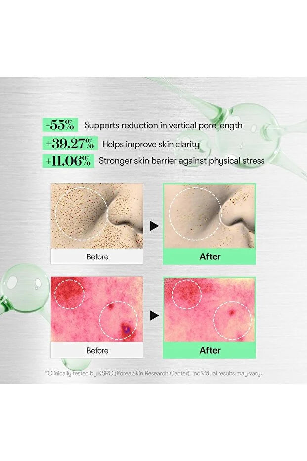 VT COSMETICS VT Reedle  shot 100