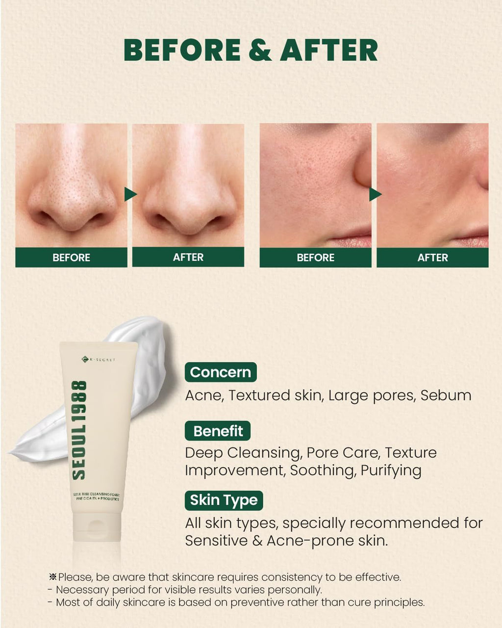 K-SECRET SEOUL 1988 Cleansing Foam : Pine Cica 1% + Probiotics  150ml