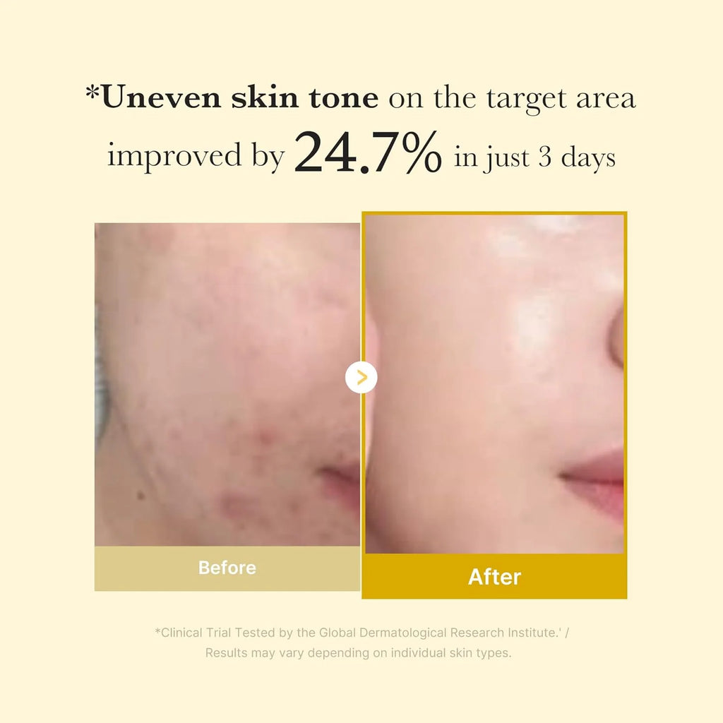 MEDICUBE KOJIC ACID TURMERIC NIGHT WRAPPING MASK 75ML