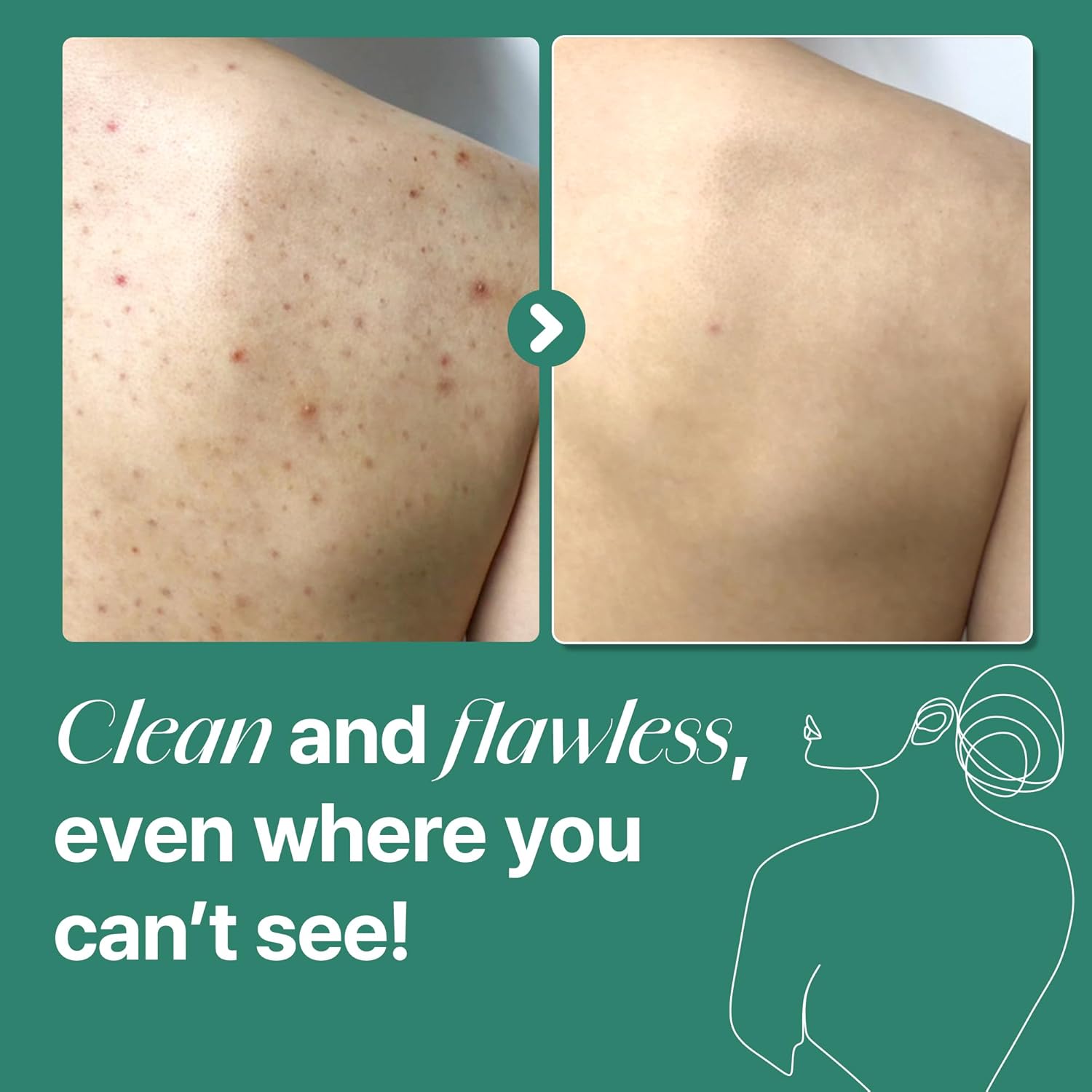 SOME BY MI AHA-BHA-PHA 30 Days Miracle Acne Body Cleanser 400g