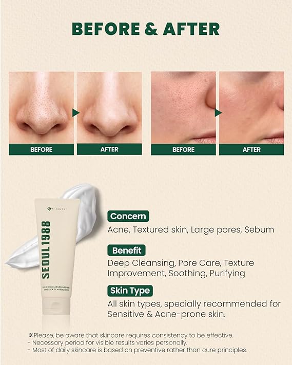 K-Secret SEOUL 1988 REPAIR CREAM : NIACICA 20% + MUGWORT 50ml