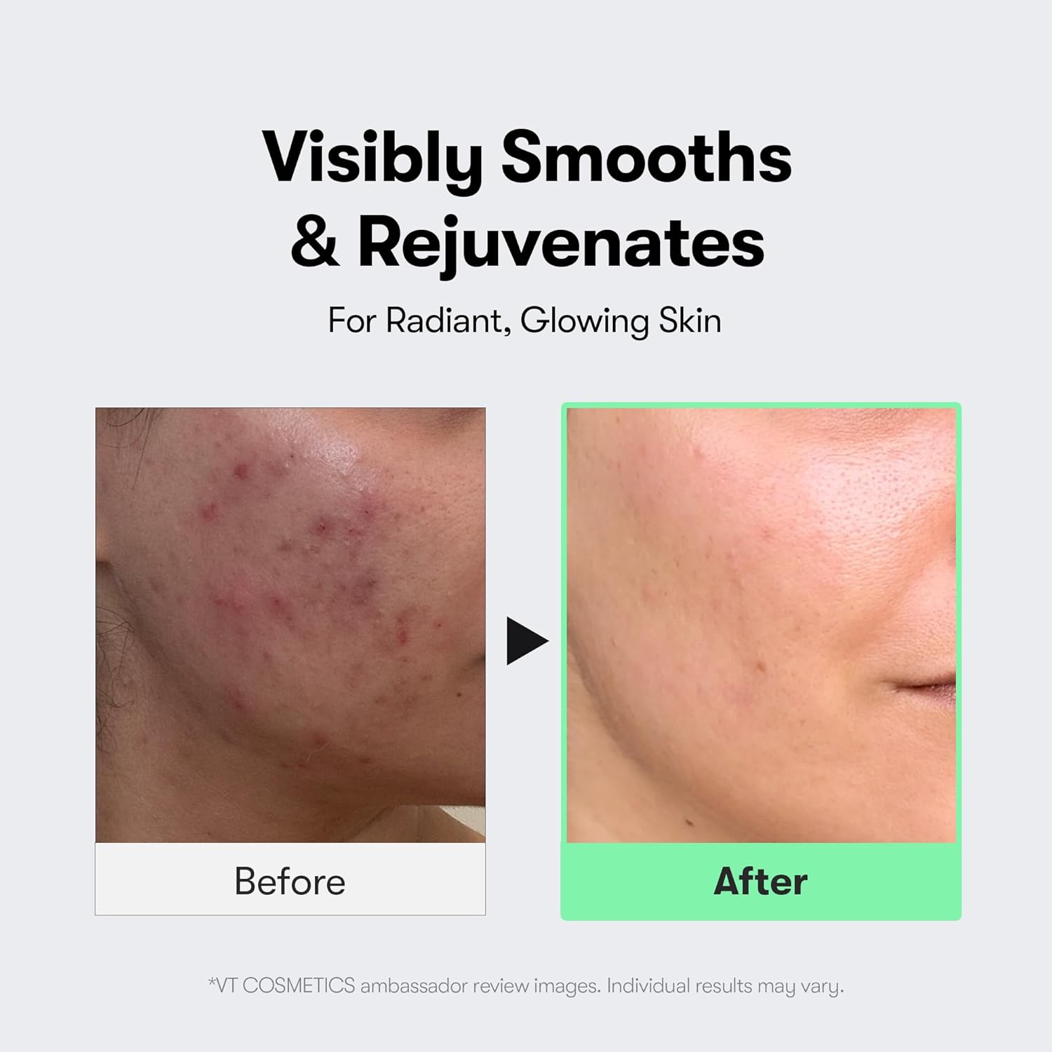 VT COSMETICS VT Mild Reedle Shot 50