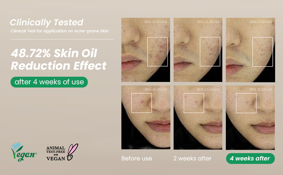 AXIS-Y Spot The Difference Blemish Treatment