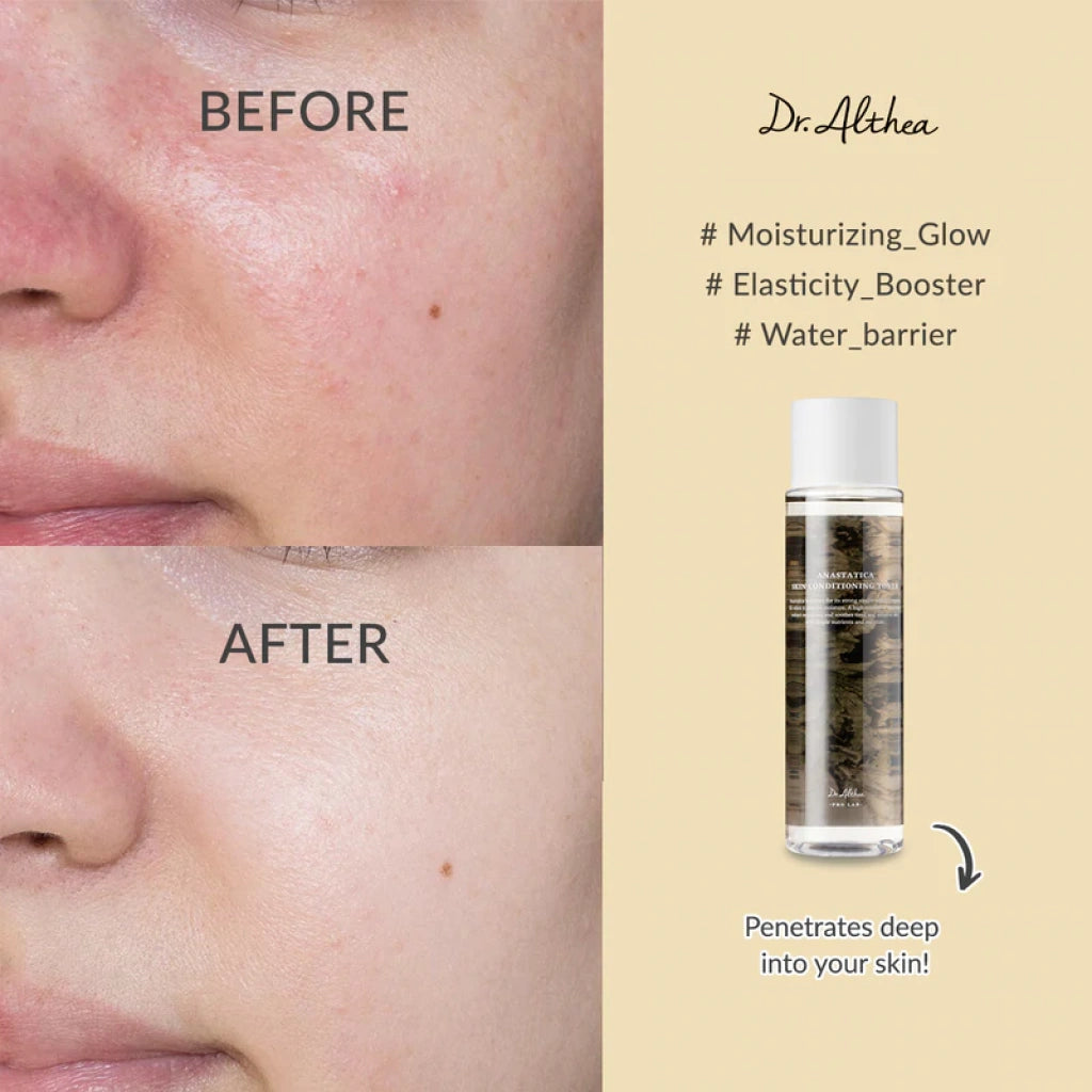 DR. ALTHEA Anastatica Skin Conditioning Toner 250ml