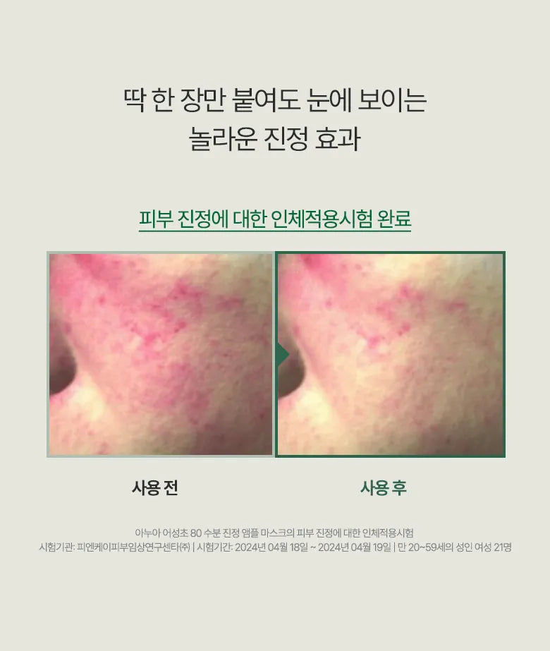 ANUA  Heartleaft 80% Soothing Ampoule Mask Sheet (10PCS)