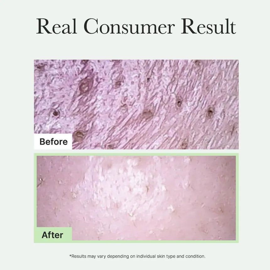 Arencia Fresh Green Rice Mochi Cleanser 120g