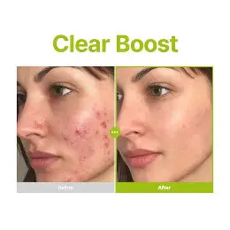 PURITO Azelaic Acid 10 Kojic Teatree Serum 30ml