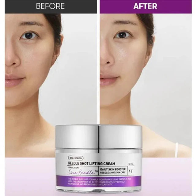 VT COSMETICS REEDLE SHOT LIFTING CREAM