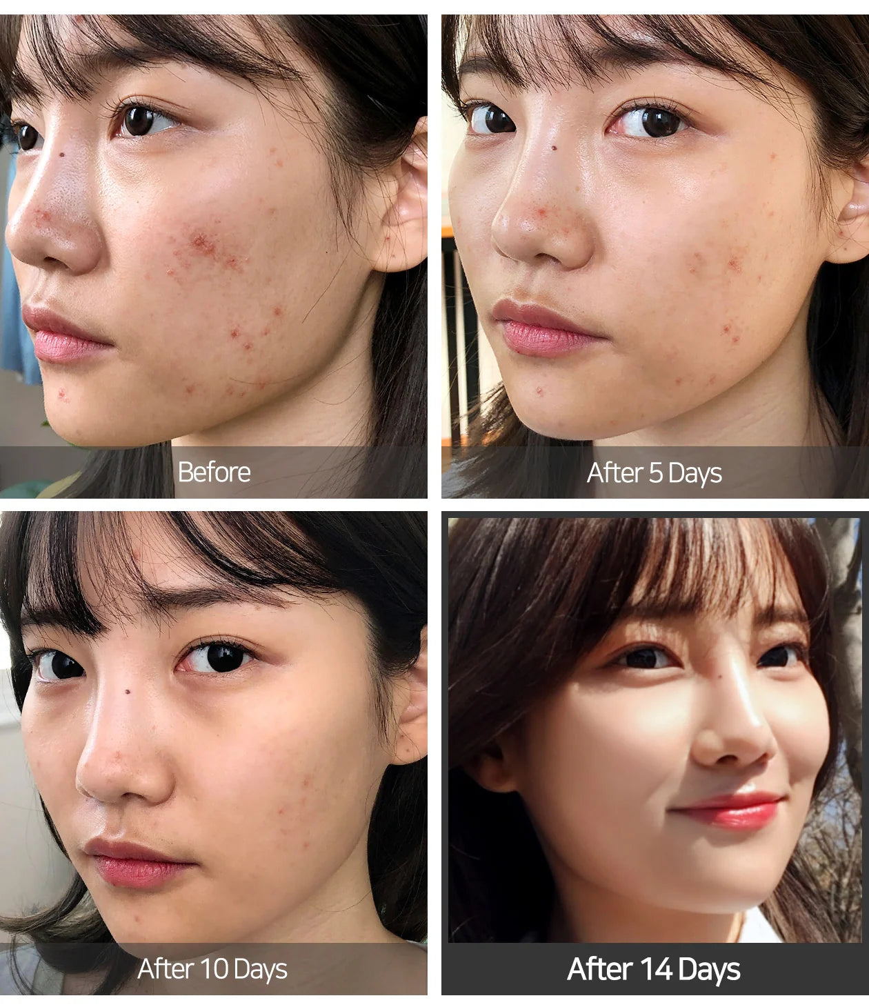 SOME BY MI AHA BHA PHA 14 Days Super Miracle Spot All Kill Cream