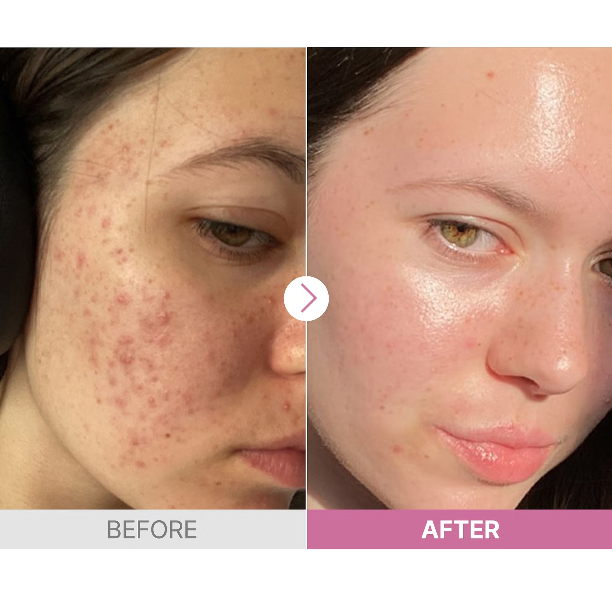 COSRX The Niacinamide 15 Serum