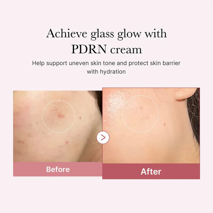 MEDICUBE PDRN PINK HYALURONIC MOISTURIZING CREAM 50ML