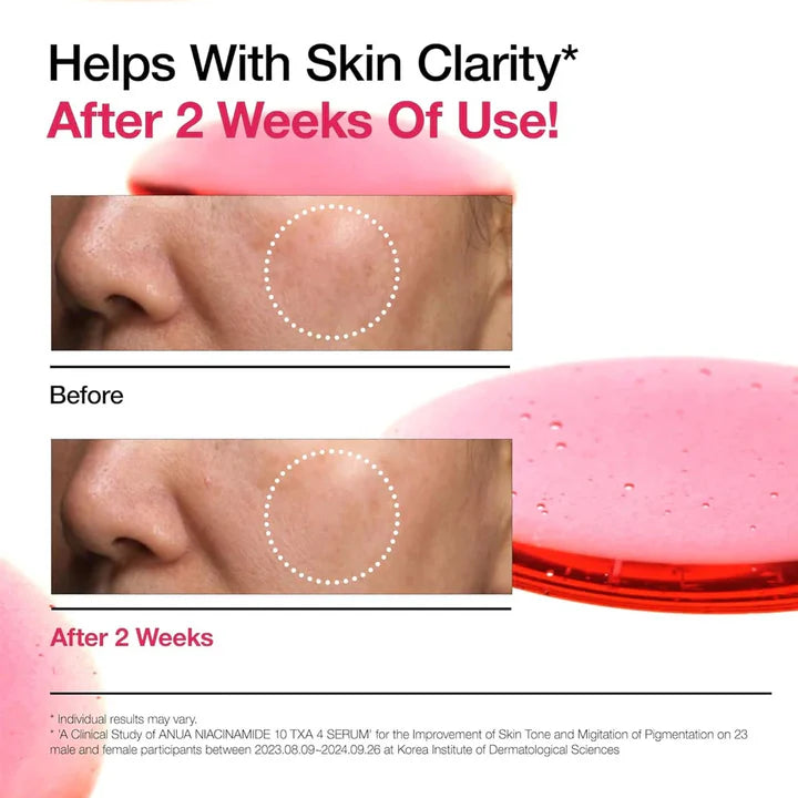 ANUA Niacinamide 10% + TXA 4% Serum 30ml