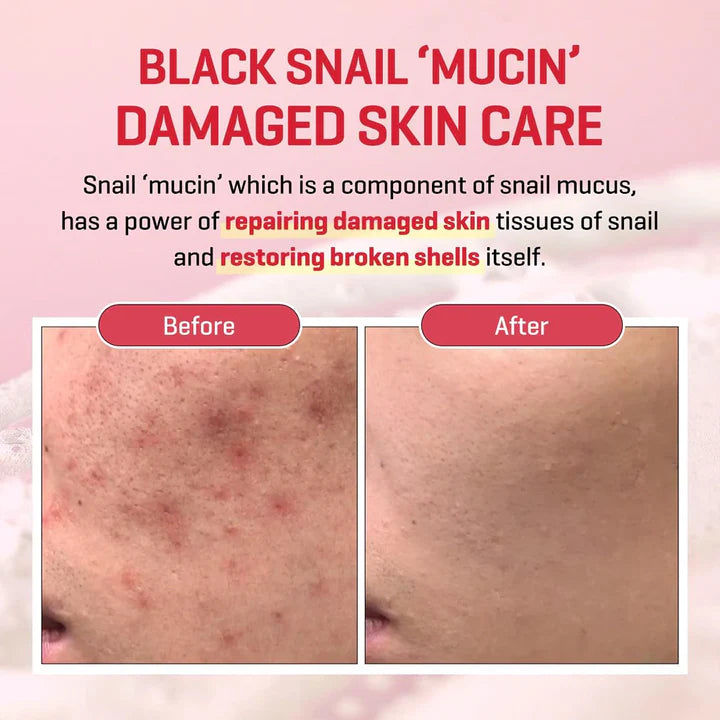 SOME BY MI Snail Truecica Miracle Repair Serum