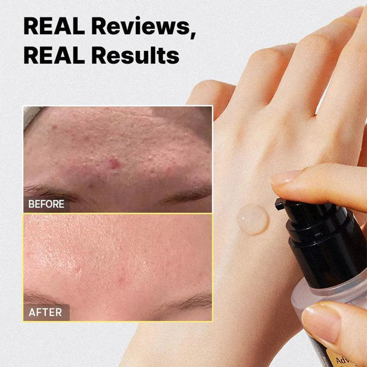 COSRX Advanced Snail 96 Mucin Power Essence 100ml