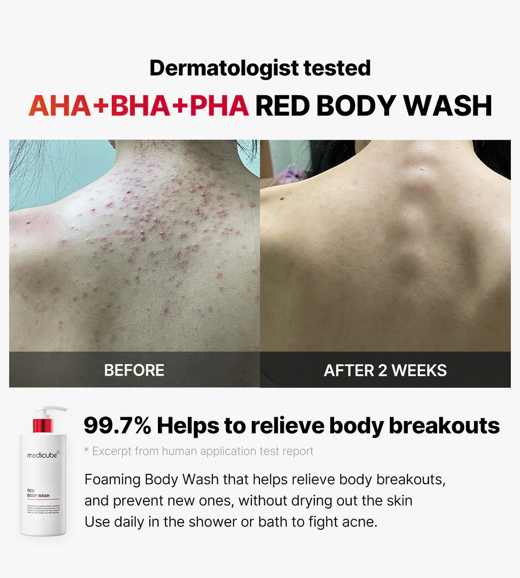 MEDICUBE RED ACNE BODY WASH 2.0 400g
